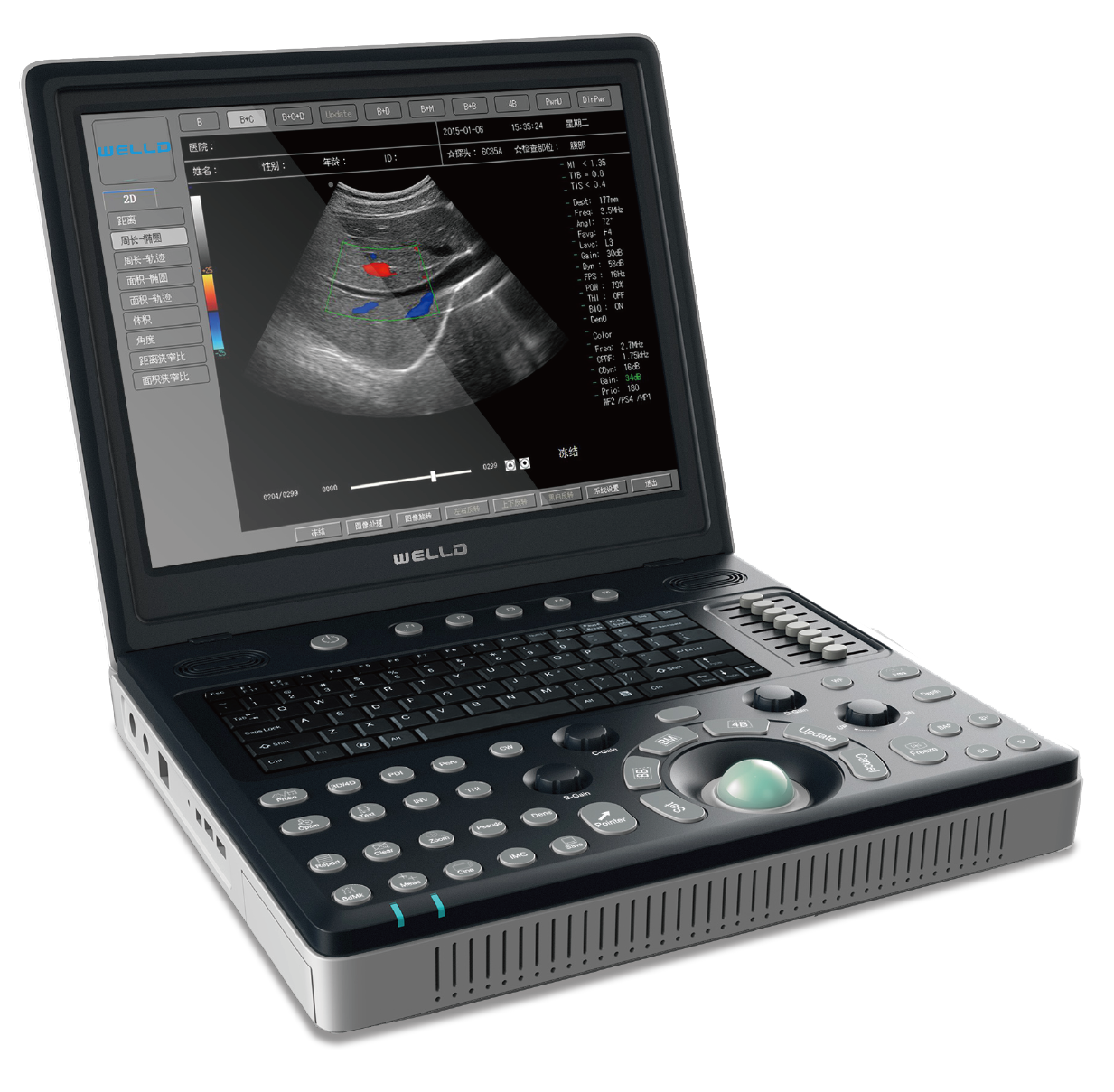 D6D6 Laptop Color Doppler Ultrasound