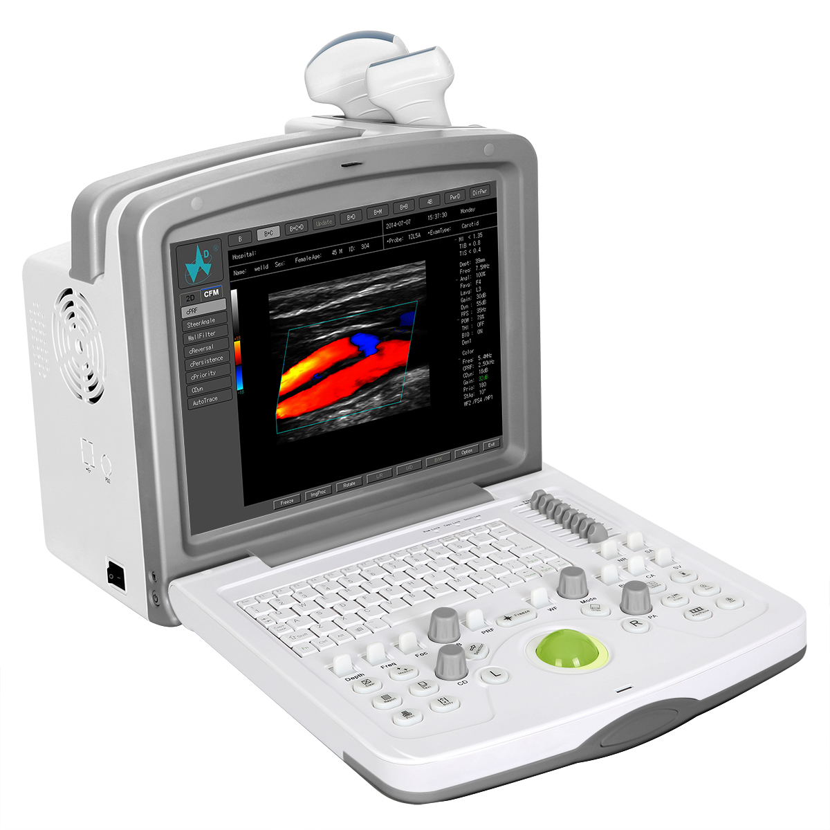 Machine à ultrasons Doppler couleur ， Présentation du produit