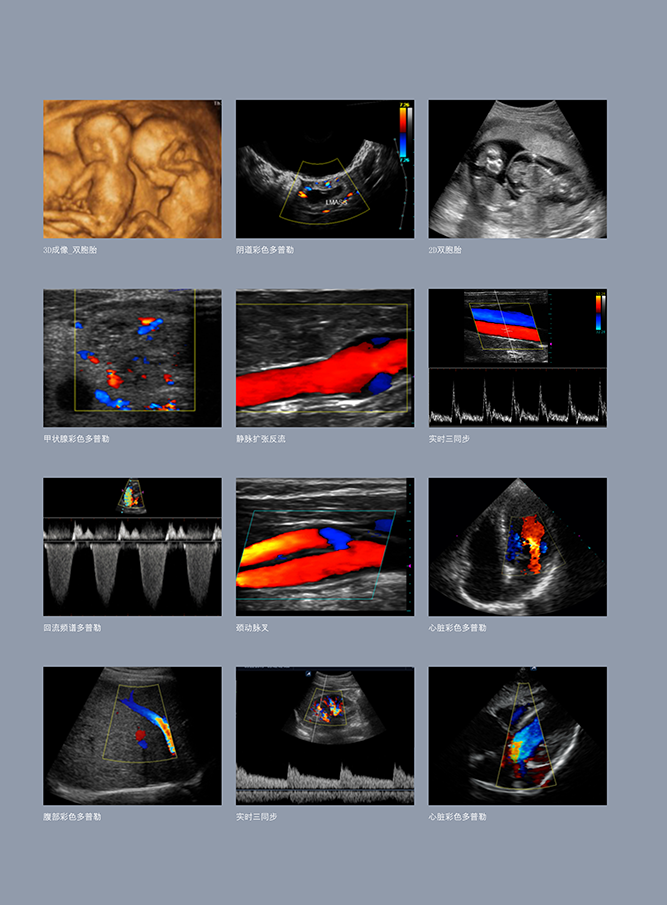 全数字彩色多普勒超声诊断系统